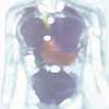 Kidney Function